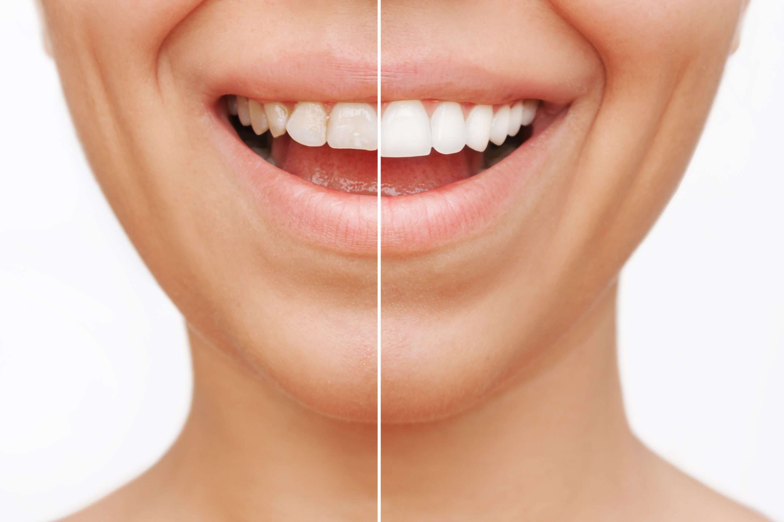 Before & After Dentistry Comparison