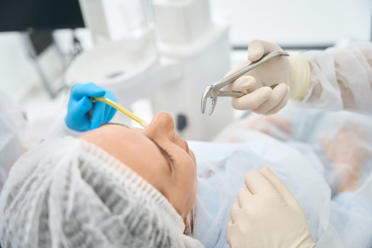 Dental Extraction Image
