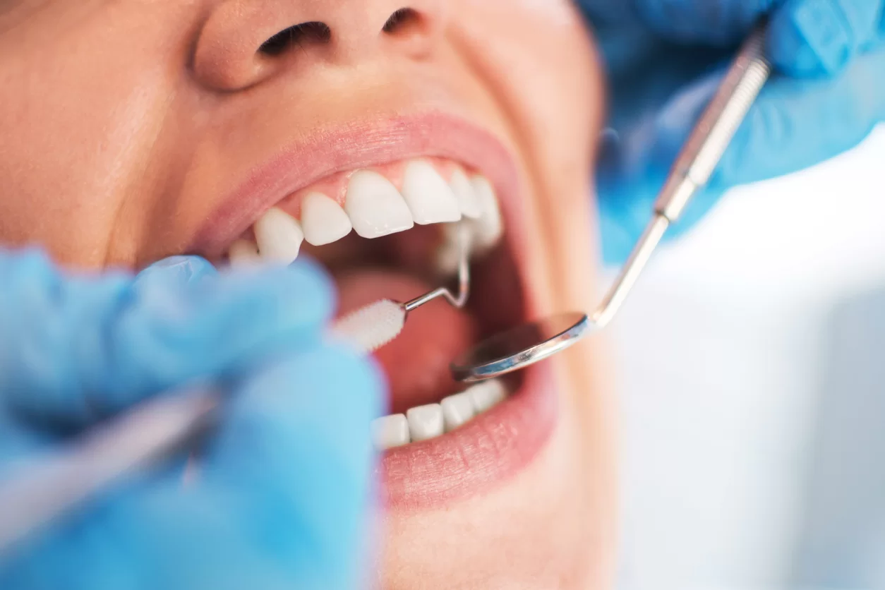 Dental procedure being performed on a woman with her mouth open