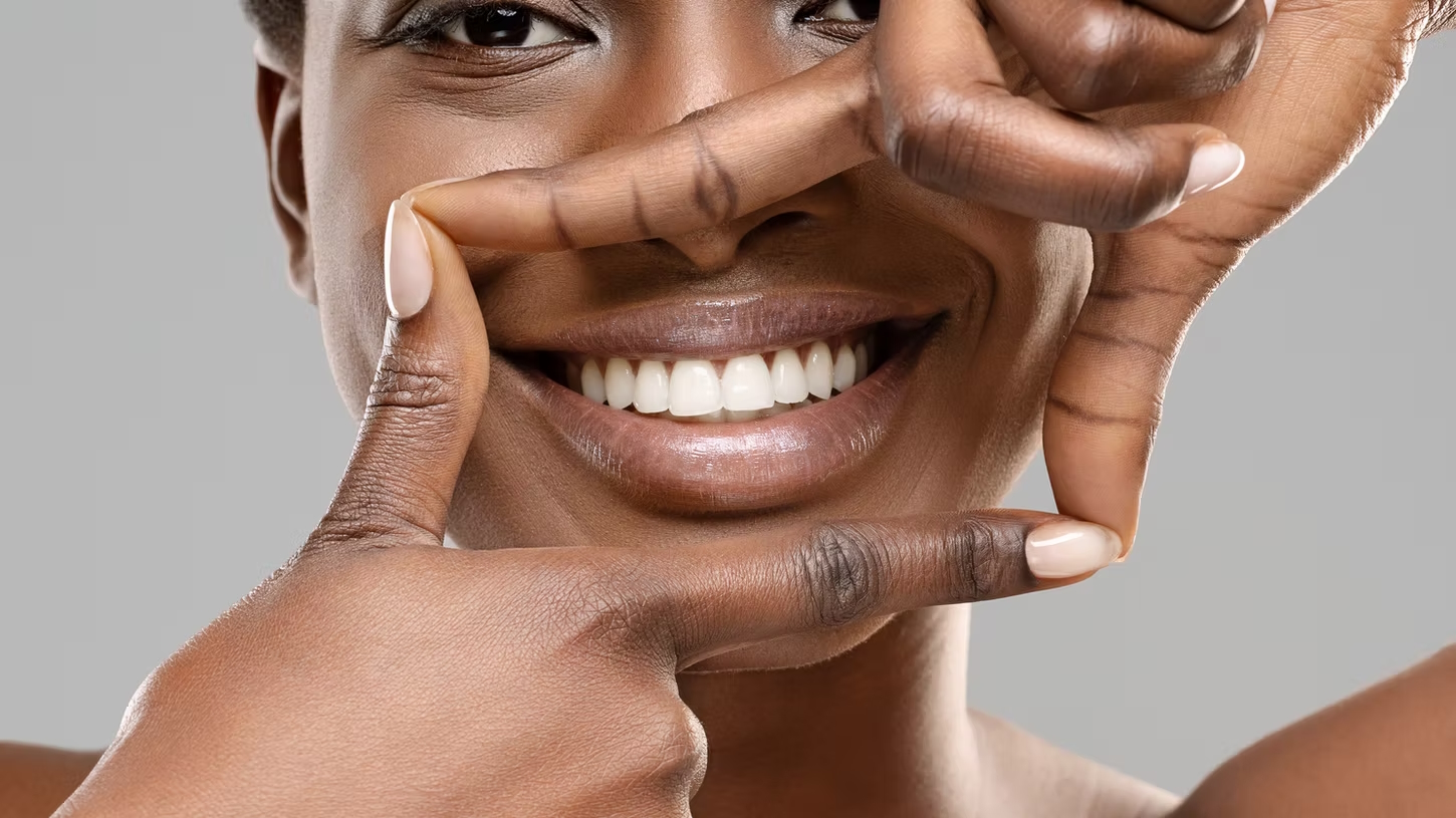 Close-up of a smiling woman with white teeth framed by her hands.