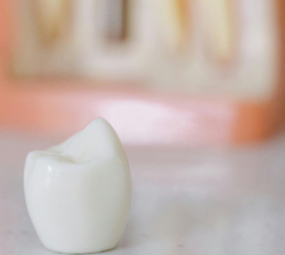 Close-up of a ceramic dental crown on display in a dental clinic.