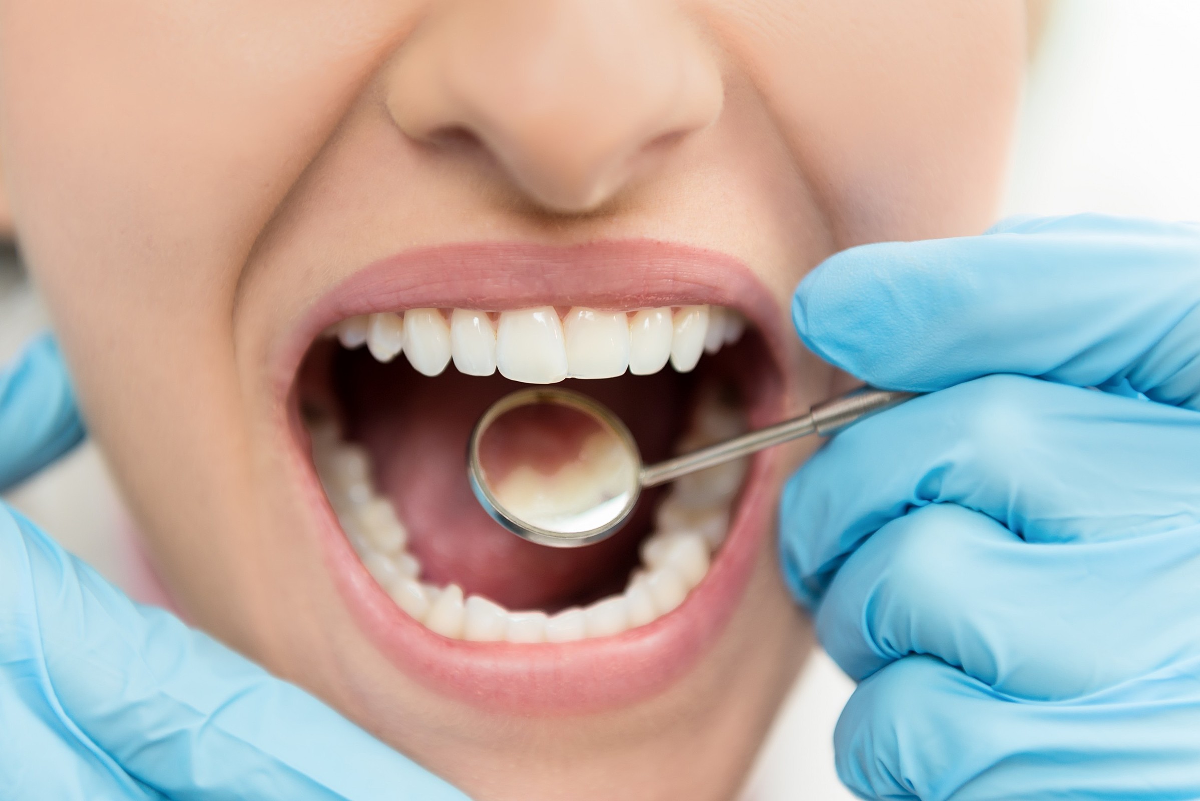 Close-up of a dental check-up with mirror inspection of healthy teeth and gums.